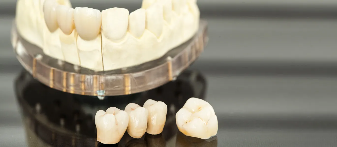 Tratamiento de prótesis dental